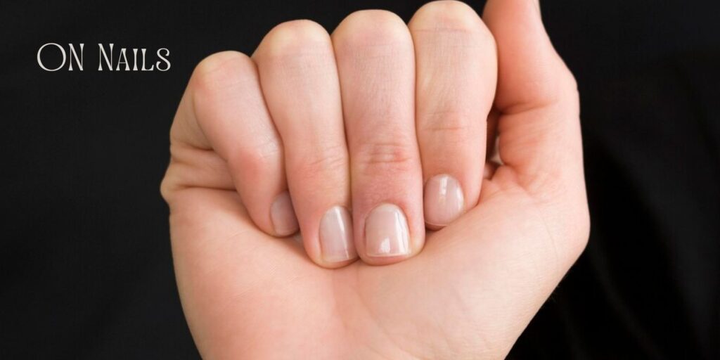  A close-up of a hand with short, clean nails, showing signs of vitamin deficiency.

