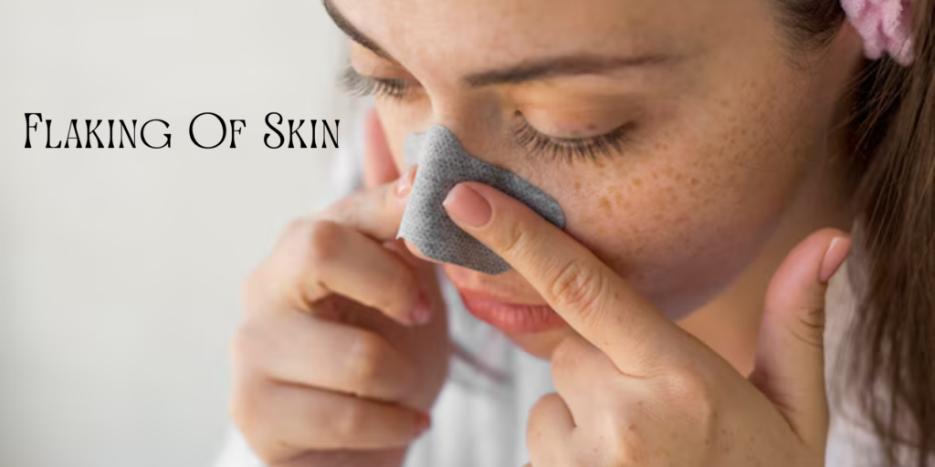  A woman gently exfoliates her face, showing flaking skin, possibly due to vitamin deficiency